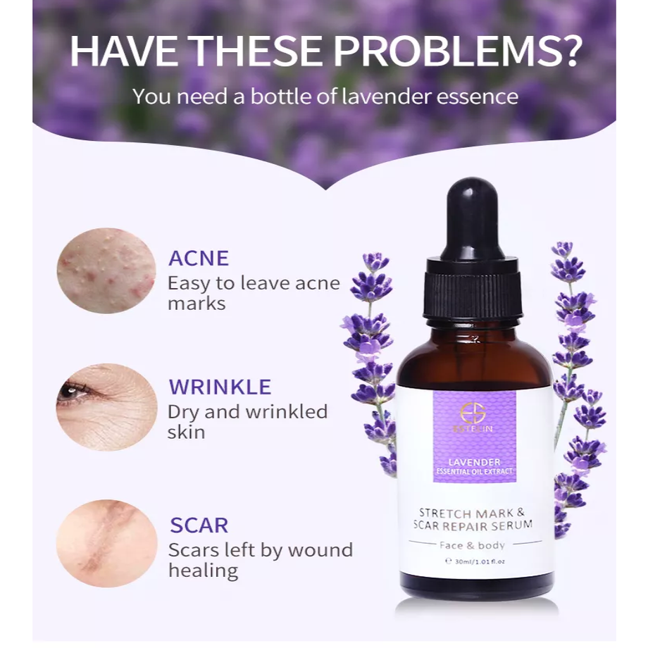 Essential oils for acne scars deals
